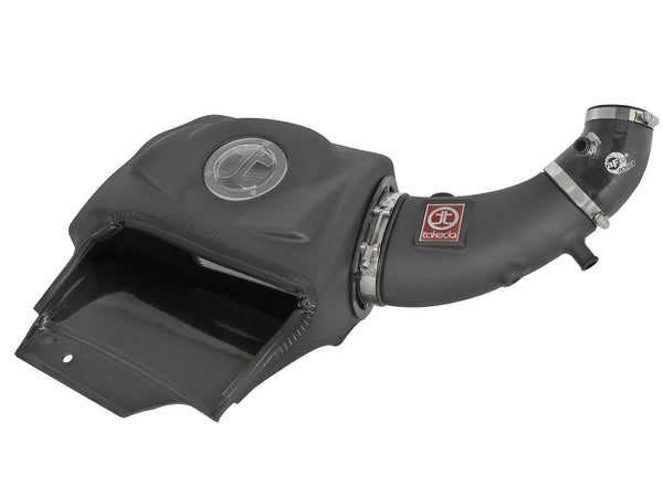 aFe Power Takeda Stage-2 Cold Air Intake System - Pro DRY S Filter - 2000-2009 Honda S2000 (AP1/AP2) (TM-1023B-D)